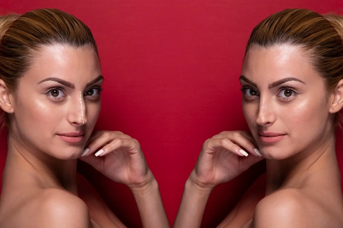 Концепция операции по ринопластике с женщиной-моделью